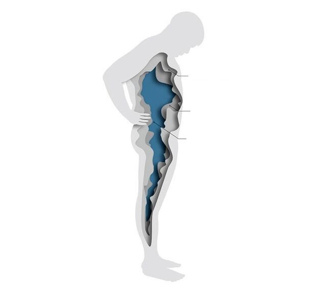 hormones et surpoids